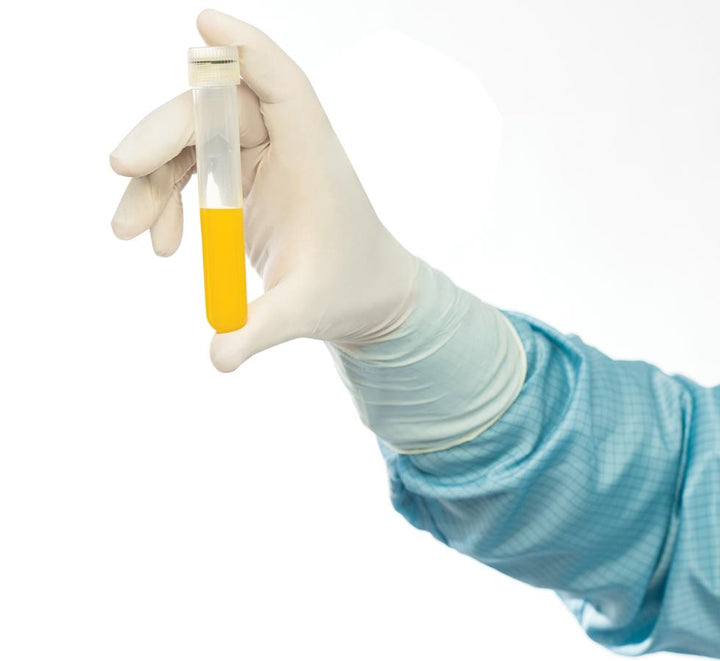 A Person in a Blue Labcoat wearing BioClean Biotac™ Non-Sterile 300mm Length White Nitrile Gloves Holding a Vial of Yellow Liquid - Sentinel Laboratories Ltd